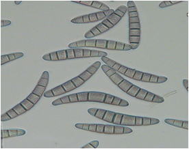 イネごま葉枯病菌の分生胞子の写真