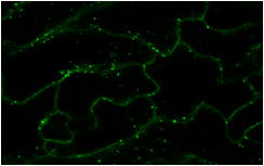 葉の細胞における輸送小胞の解析の写真